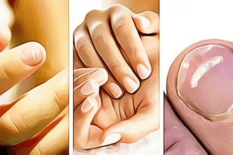 Quels Traitements Efficaces Pour Les Infections De Mycoses Des Ongles